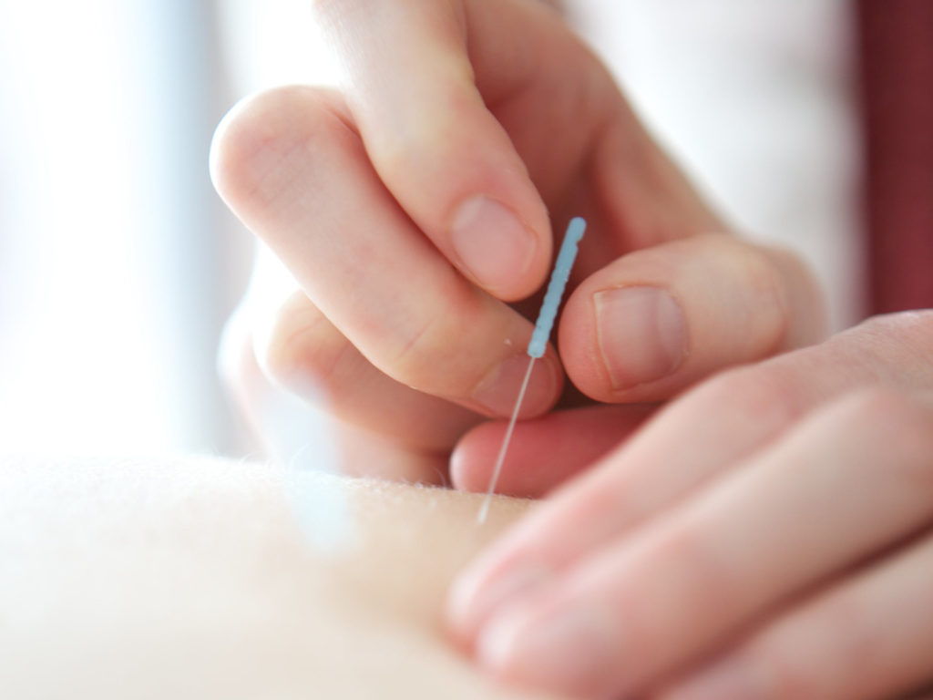 What can acupuncture  do?